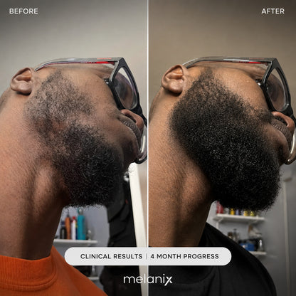 Beard Regrowth Adenosine & GHK-Cu Micro-Infusion System
