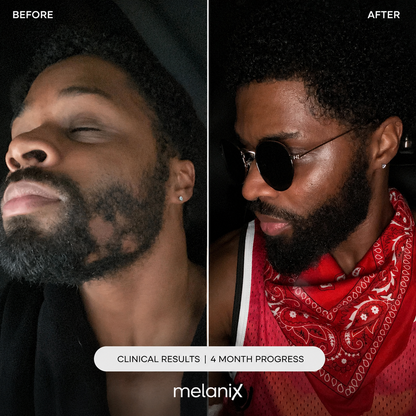 Beard Regrowth Adenosine & GHK-Cu Micro-Infusion System