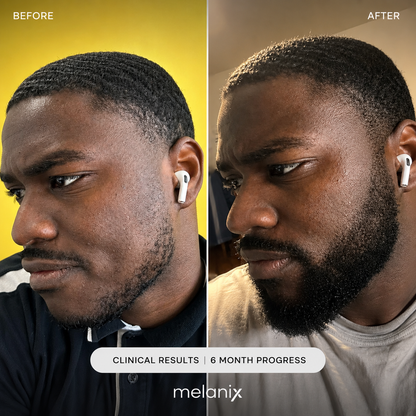 Beard Regrowth Adenosine & GHK-Cu Micro-Infusion System