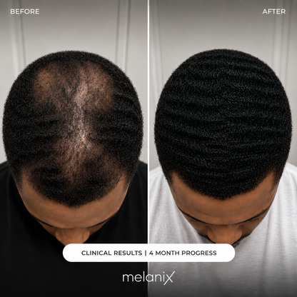Hair Regrowth 2.0 Adenosine & GHK-Cu Micro-Infusion System